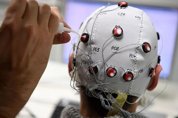 Implantes cerebrales en China
