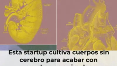 Cuerpos humanos sin cerebro cultivados en laboratorio
