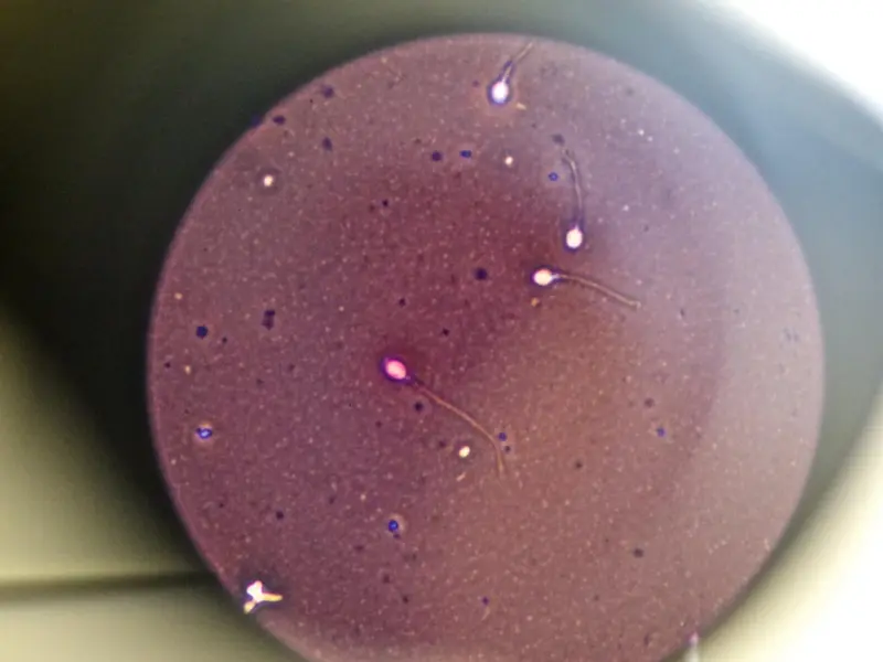 Hombre sonriendo con un fondo de espermatozoides