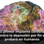 El primer implante cerebral contra la depresión por fin se probará en humanos