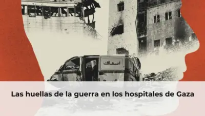 Las huellas de la guerra en los hospitales de Gaza
