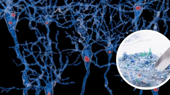 Microplásticos en tu cerebro: ¿la clave oculta de los tumores?