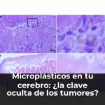 Microplásticos en tu cerebro: ¿la clave oculta de los tumores?
