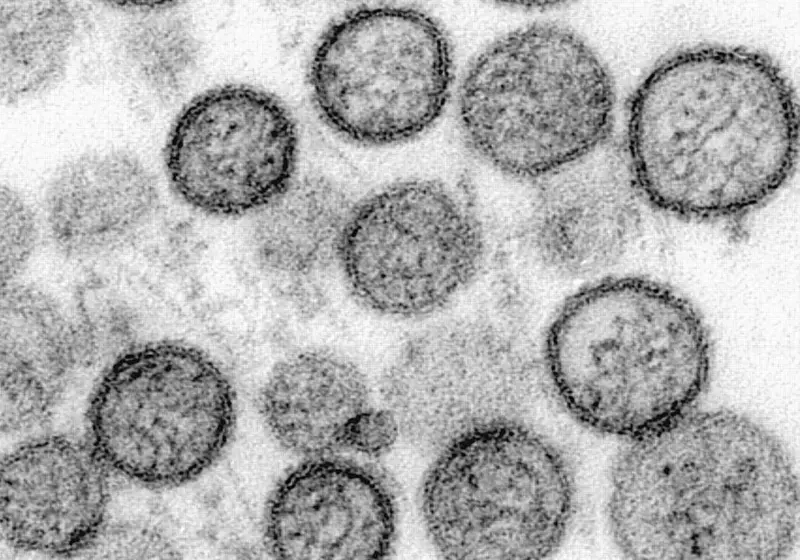 La primera secuenciación genética del hantavirus en el MV Hondius confirma transmisión de persona a persona