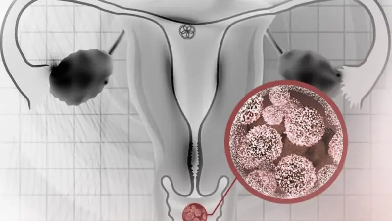 La tendencia de optimizar el microbioma vaginal con pruebas caseras parte de una idea equivocada