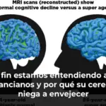 Por fin estamos entendiendo a los superancianos y por qué su cerebro se niega a envejecer