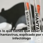 Todo lo que tienes que saber sobre el hantavirus, explicado por un infectólogo