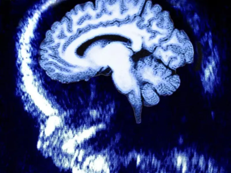 El cerebro no nace siendo un 'lienzo en blanco'