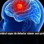 Este implante cerebral capaz de detectar cáncer será probado por primera vez