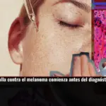 La nueva batalla contra el melanoma comienza antes del diagnóstico